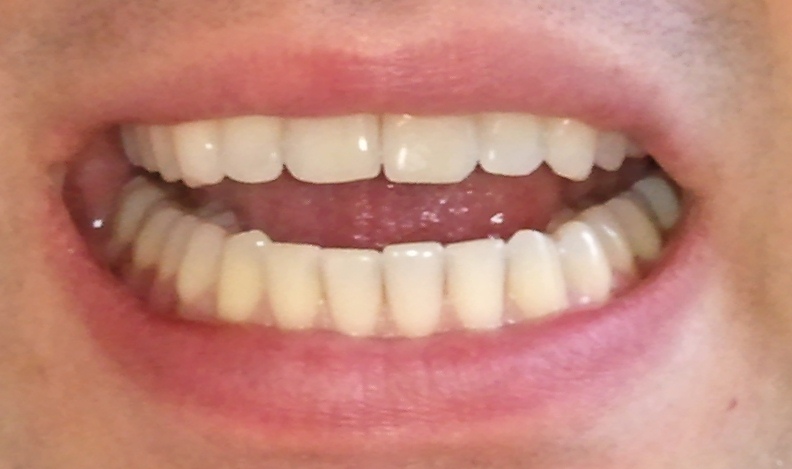 De face, légèrement ouvert